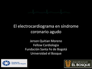 El electrocardiograma en síndrome
          coronario agudo
        Jerson Quitian Moreno
          Fellow Cardiologia
     Fundación Santa Fe de Bogotá
        Universidad el Bosque
 