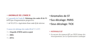 • ANOMALIE DE L'ONDE R
• 1 anomalie de l'onde R: Rabotage des ondes R de Vl
à V3 (pas d'augmentation progressive
• de Vl à V3) = équivalent d'une onde Q de nécrose
3 causes de rabotage des ondes R de V 1 à V3
• □ Séquelle d'IDM antéro-septal
• □ BBG
• □ HVG
•Anomalies de ST
•Sus décalage: PARIS
•Sous décalage: TICK
• INTERVALLE QT
• La mesure du segment QT sur l'ECG donne des
renseignements sur la repolarisation cardiaque
 
