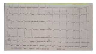 EKG_INTERPRETATION.pptx.pdf