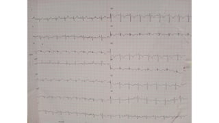 EKG_INTERPRETATION.pptx.pdf