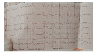 EKG_INTERPRETATION.pptx.pdf