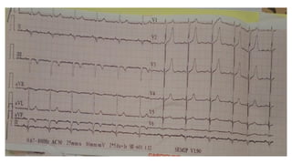 EKG_INTERPRETATION.pptx.pdf