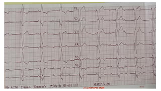 EKG_INTERPRETATION.pptx.pdf