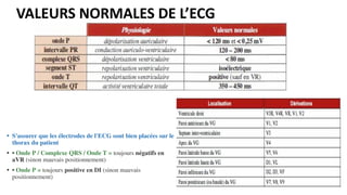 VALEURS NORMALES DE L’ECG
• S'assurer que les électrodes de l'ECG sont bien placées sur le
thorax du patient
• • Onde P / Complexe QRS / Onde T = toujours négatifs en
aVR (sinon mauvais positionnement)
• • Onde P = toujours positive en DI (sinon mauvais
positionnement)
 