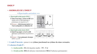 ONDE P
• ANOMALIES DE L'ONDE P
• Hypertrophie auriculaire +++
• Si onde P inversée : penser à un rythme jonctionnel ou rythme du sinus coronaire.
• Si absence d'onde P :
3 si tachycardie : FA +++ à petite maille - TV - T J
2 si bradycardie: BSA 2 (absence intermittente)/ BSA 3 (absence permanente)
 