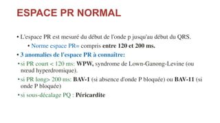 ESPACE PR NORMAL
• L'espace PR est mesuré du début de l'onde p jusqu'au début du QRS.
• Norme espace PR= compris entre 120 et 200 ms.
• 3 anomalies de l'espace PR à connaître:
•si PR court < 120 ms: WPW, syndrome de Lown-Ganong-Levine (ou
nœud hyperdromique).
•si PR long> 200 ms: BAV-1 (si absence d'onde P bloquée) ou BAV-11 (si
onde P bloquée)
•si sous-décalage PQ : Péricardite
 