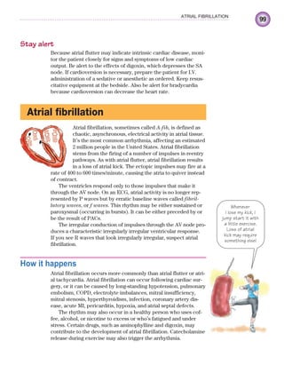 99
ATRIAL FIBRILLATION
Stay alert
Because atrial flutter may indicate intrinsic cardiac disease, moni-
tor the patient closely for signs and symptoms of low cardiac
output. Be alert to the effects of digoxin, which depresses the SA
node. If cardioversion is necessary, prepare the patient for I.V.
administration of a sedative or anesthetic as ordered. Keep resus-
citative equipment at the bedside. Also be alert for bradycardia
because cardioversion can decrease the heart rate.
Atrial fibrillation
Atrial fibrillation, sometimes called A-fib, is defined as
chaotic, asynchronous, electrical activity in atrial tissue.
It’s the most common arrhythmia, affecting an estimated
2 million people in the United States. Atrial fibrillation
stems from the firing of a number of impulses in reentry
pathways. As with atrial flutter, atrial fibrillation results
in a loss of atrial kick. The ectopic impulses may fire at a
rate of 400 to 600 times/minute, causing the atria to quiver instead
of contract.
The ventricles respond only to those impulses that make it
through the AV node. On an ECG, atrial activity is no longer rep-
resented by P waves but by erratic baseline waves called fibril-
latory waves, or f waves. This rhythm may be either sustained or
paroxysmal (occurring in bursts). It can be either preceded by or
be the result of PACs.
The irregular conduction of impulses through the AV node pro-
duces a characteristic irregularly irregular ventricular response.
If you see R waves that look irregularly irregular, suspect atrial
fibrillation.
How it happens
Atrial fibrillation occurs more commonly than atrial flutter or atri-
al tachycardia. Atrial fibrillation can occur following cardiac sur-
gery, or it can be caused by long-standing hypotension, pulmonary
embolism, COPD, electrolyte imbalances, mitral insufficiency,
mitral stenosis, hyperthyroidism, infection, coronary artery dis-
ease, acute MI, pericarditis, hypoxia, and atrial septal defects.
The rhythm may also occur in a healthy person who uses cof-
fee, alcohol, or nicotine to excess or who’s fatigued and under
stress. Certain drugs, such as aminophylline and digoxin, may
contribute to the development of atrial fibrillation. Catecholamine
release during exercise may also trigger the arrhythmia.
Whenever
I lose my kick, I
jump start it with
a little exercise.
Loss of atrial
kick may require
something else!
ECG_Chap05.indd 99
ECG_Chap05.indd 99 7/8/2010 12:32:37 PM
7/8/2010 12:32:37 PM
 