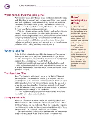 100
ATRIAL ARRHYTHMIAS
Where have all the atrial kicks gone?
As with other atrial arrhythmias, atrial fibrillation eliminates atrial
kick. That loss, combined with the decreased filling times associ-
ated with rapid rates, can lead to clinically significant problems.
If the ventricular response is greater than 100 beats/minute—a
condition called uncontrolled atrial fibrillation—the patient may
develop heart failure, angina, or syncope.
Patients with preexisting cardiac disease, such as hypertrophic
obstructive cardiomyopathy, mitral stenosis, rheumatic heart
disease, and mitral prosthetic valves, tend to tolerate atrial fibrilla-
tion poorly and may develop shock and severe heart failure.
Left untreated, atrial fibrillation can lead to cardiovascular
collapse, thrombus formation, and systemic arterial or pulmonary
embolism. (See Risk of restoring sinus rhythm.)
What to look for
Atrial fibrillation is distinguished by the absence of P waves and
an irregular ventricular response. When several ectopic sites in
the atria fire impulses, depolarization can’t spread in an organized
manner. (See Identifying atrial fibrillation.)
Small sections of the atria are activated individually, which
results in the atrial muscle quivering instead of contracting. On an
ECG, you’ll see uneven baseline f waves rather than clearly distin-
guishable P waves.
That fabulous filter
The AV node protects the ventricles from the 400 to 600 erratic
atrial impulses that occur each minute by acting as a filter and
blocking some of the impulses. The AV node itself doesn’t receive
all the impulses, however. If muscle tissue around the AV node is
in a refractory state, impulses from other areas of the atria can’t
reach the AV node, which further reduces the number of atrial im-
pulses conducted through to the ventricles.
Those two factors help explain the characteristic wide varia-
tion in R-R intervals in atrial fibrillation.
Barely measurable
The atrial rate is almost indiscernible but is usually greater than
400 beats/minute. The ventricular rate usually varies from 100 to
150 beats/minute but can be lower. When the ventricular response
rate is below 100, atrial fibrillation is considered controlled. When
it exceeds 100, the rhythm is considered uncontrolled.
Atrial fibrillation is called coarse if the f waves are pronounced
and fine if they aren’t. Atrial fibrillation and flutter may also
Risk of
restoring sinus
rhythm
A patient with atrial fi-
brillation is at increased
risk for developing atrial
thrombus and systemic
arterial embolism. Be-
cause the atria don’t
contract, blood may pool
on the atrial wall, and
thrombi can form.
If normal sinus
rhythm is restored and
the atria contract nor-
mally, clots can break
away and travel through
the pulmonary or sys-
temic circulation with
potentially disastrous
results.
ECG_Chap05.indd 100
ECG_Chap05.indd 100 7/8/2010 12:32:39 PM
7/8/2010 12:32:39 PM
 