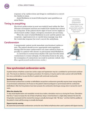 102
ATRIAL ARRHYTHMIAS
response or by cardioversion and drugs in combination to convert
the rhythm to sinus.
Atrial fibrillation is treated following the same guidelines as
atrial flutter.
Timing is everything
Electrical cardioversion is most successful if used within the first
48 hours of treatment and less successful if the rhythm has existed
for a long time. If the patient shows signs of more severe angina or
of decreased cardiac output, emergency measures are necessary.
When the onset of atrial fibrillation is acute and the patient can
cooperate, vagal maneuvers or carotid sinus massage may slow
the ventricular response but won’t convert the arrhythmia.
Cardioversion
A symptomatic patient needs immediate synchronized cardiover-
sion. The patient should receive appropriate anticoagulation
therapy first because cardioversion can cause emboli to form, es-
pecially in a patient with chronic or paroxysmal atrial fibrillation.
A conversion to normal sinus rhythm will cause forceful atrial
contractions to resume abruptly. If a thrombus forms in the atria,
the resumption of contractions can result in systemic emboli. (See
How synchronized cardioversion works.)
How synchronized cardioversion works
A patient whose arrhythmia causes low cardiac output and hypotension may be a candidate for synchronized cardiover-
sion. This may be an elective or emergency procedure. For instance, it may be used to make a person with atrial fibrilla-
tion more comfortable or to save the life of a patient with ventricular tachycardia.
Synchronize the energy
Synchronized cardioversion is similar to defibrillation except that cardioversion generally requires lower energy levels.
In synchronized cardioversion, the R wave on the patient’s electrocardiogram is synchronized with the cardioverter
(defibrillator). After the firing buttons have been pressed, the cardioverter discharges energy when it senses the next R
wave.
When the stimulus hits
To stop atrial depolarization and reestablish normal sinus rhythm, stimulation must occur during the R wave. Stimulation
that hits a T wave increases the risk of fatal arrhythmias. Keep in mind that there’s a slight delay between the time the
firing button is pressed and the moment the energy is actually discharged. Call, “All clear,” and then hold the paddles to
the patient’s chest until the energy is actually discharged.
Digoxin toxicity warning
Be aware that synchronized cardioversion carries the risk of lethal arrhythmias when used in patients with digoxin toxicity.
Immediate
synchronized
cardioversion
reestablishes normal
sinus rhythm in a
symptomatic patient.
Rhythm is very
important!
ECG_Chap05.indd 102
ECG_Chap05.indd 102 7/8/2010 12:32:39 PM
7/8/2010 12:32:39 PM
 