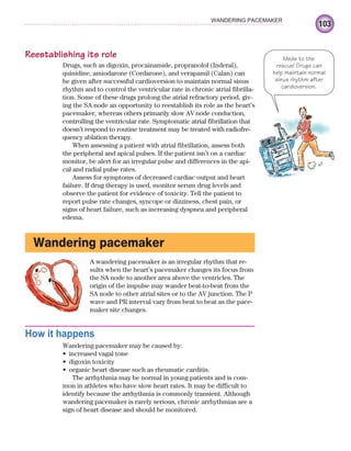 103
WANDERING PACEMAKER
Reestablishing its role
Drugs, such as digoxin, procainamide, propranolol (Inderal),
quinidine, amiodarone (Cordarone), and verapamil (Calan) can
be given after successful cardioversion to maintain normal sinus
rhythm and to control the ventricular rate in chronic atrial fibrilla-
tion. Some of these drugs prolong the atrial refractory period, giv-
ing the SA node an opportunity to reestablish its role as the heart’s
pacemaker, whereas others primarily slow AV node conduction,
controlling the ventricular rate. Symptomatic atrial fibrillation that
doesn’t respond to routine treatment may be treated with radiofre-
quency ablation therapy.
When assessing a patient with atrial fibrillation, assess both
the peripheral and apical pulses. If the patient isn’t on a cardiac
monitor, be alert for an irregular pulse and differences in the api-
cal and radial pulse rates.
Assess for symptoms of decreased cardiac output and heart
failure. If drug therapy is used, monitor serum drug levels and
observe the patient for evidence of toxicity. Tell the patient to
report pulse rate changes, syncope or dizziness, chest pain, or
signs of heart failure, such as increasing dyspnea and peripheral
edema.
Wandering pacemaker
A wandering pacemaker is an irregular rhythm that re-
sults when the heart’s pacemaker changes its focus from
the SA node to another area above the ventricles. The
origin of the impulse may wander beat-to-beat from the
SA node to other atrial sites or to the AV junction. The P
wave and PR interval vary from beat to beat as the pace-
maker site changes.
How it happens
Wandering pacemaker may be caused by:
increased vagal tone
•
digoxin toxicity
•
organic heart disease such as rheumatic carditis.
•
The arrhythmia may be normal in young patients and is com-
mon in athletes who have slow heart rates. It may be difficult to
identify because the arrhythmia is commonly transient. Although
wandering pacemaker is rarely serious, chronic arrhythmias are a
sign of heart disease and should be monitored.
Meds to the
rescue! Drugs can
help maintain normal
sinus rhythm after
cardioversion.
ECG_Chap05.indd 103
ECG_Chap05.indd 103 7/8/2010 12:32:40 PM
7/8/2010 12:32:40 PM
 