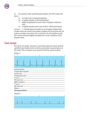 108
ATRIAL ARRHYTHMIAS
6. In a patient with wandering pacemaker, the ECG strip will
show:
A. an early beat causing irregularity.
B. a regular rhythm of 40 beats/minute.
C. slight irregularity because sites of impulse initiation
vary.
D. a regular rhythm and a rate of 60 to 100 beats/minute.
Answer: C. Wandering pacemaker is an irregular rhythm that
results when the heart’s pacemaker changes its focus from the SA
node to another area above the ventricles. So, the rhythm on the
ECG strip will look slightly irregular due to the variation of the
impulse sites.
Test strips
Try these test strips. Interpret each strip using the 8-step method
and fill in the blanks below with the particular characteristics of
the strip. Then compare your answers with the answers given.
Strip 1
Atrial rhythm:
Ventricular rhythm:
Atrial rate:
Ventricular rate:
P wave:
PR interval:
QRS complex:
T wave:
QT interval:
Other:
Interpretation:
Strip 2
ECG_Chap05.indd 108
ECG_Chap05.indd 108 7/8/2010 12:32:42 PM
7/8/2010 12:32:42 PM
 