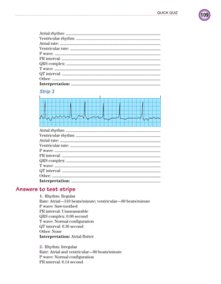 109
QUICK QUIZ
Atrial rhythm:
Ventricular rhythm:
Atrial rate:
Ventricular rate:
P wave:
PR interval:
QRS complex:
T wave:
QT interval:
Other:
Interpretation:
Strip 3
Atrial rhythm:
Ventricular rhythm:
Atrial rate:
Ventricular rate:
P wave:
PR interval:
QRS complex:
T wave:
QT interval:
Other:
Interpretation:
Answers to test strips
1. Rhythm: Regular
Rate: Atrial—310 beats/minute; ventricular—80 beats/minute
P wave: Saw-toothed
PR interval: Unmeasurable
QRS complex: 0.08 second
T wave: Normal configuration
QT interval: 0.36 second
Other: None
Interpretation: Atrial flutter
2. Rhythm: Irregular
Rate: Atrial and ventricular—80 beats/minute
P wave: Normal configuration
PR interval: 0.14 second
ECG_Chap05.indd 109
ECG_Chap05.indd 109 7/8/2010 12:32:42 PM
7/8/2010 12:32:42 PM
 