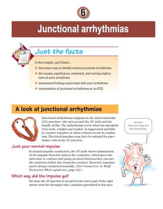 Junctional arrhythmias
Junctional arrhythmias
6
In this chapter, you’ll learn:
the proper way to identify various junctional arrhythmias

the causes, significance, treatment, and nursing implica-

tions of each arrhythmia
assessment findings associated with each arrhythmia

interpretation of junctional arrhythmias on an ECG.

Just the facts
A look at junctional arrhythmias
Junctional arrhythmias originate in the atrioventricular
(AV) junction—the area around the AV node and the
bundle of His. The arrhythmias occur when the sinoatrial
(SA) node, a higher pacemaker, is suppressed and fails
to conduct impulses or when a block occurs in conduc-
tion. Electrical impulses may then be initiated by pace-
maker cells in the AV junction.
Just your normal impulse
In normal impulse conduction, the AV node slows transmission
of the impulse from the atria to the ventricles, which gives the
atria time to contract and pump as much blood as they can into
the ventricles before the ventricles contract. However, impulses
aren’t always conducted normally. (See Conduction in Wolff-
Parkinson-White syndrome, page 112.)
Which way did the impulse go?
Because the AV junction is located in the lower part of the right
atrium near the tricuspid valve, impulses generated in this area
Normal
impulses keep the
blood pumping.
ECG_Chap06.indd 111
ECG_Chap06.indd 111 7/7/2010 5:56:55 PM
7/7/2010 5:56:55 PM
 