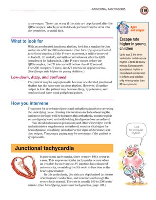 119
JUNCTIONAL TACHYCARDIA
urine output. These can occur if the atria are depolarized after the
QRS complex, which prevents blood ejection from the atria into
the ventricles, or atrial kick.
What to look for
With an accelerated junctional rhythm, look for a regular rhythm
and a rate of 60 to 100 beats/minute. (See Identifying accelerated
junctional rhythm.) If the P wave is present, it will be inverted
in leads II, III, and aVF and will occur before or after the QRS
complex or be hidden in it. If the P wave comes before the
QRS complex, the PR interval will be less than 0.12 second.
The QRS complex, T wave, and QT interval all appear normal.
(See Escape rate higher in young children.)
Low-down, dizzy, and confused
The patient may be asymptomatic because accelerated junctional
rhythm has the same rate as sinus rhythm. However, if cardiac
output is low, the patient may become dizzy, hypotensive, and
confused and have weak peripheral pulses.
How you intervene
Treatment for accelerated junctional arrhythmia involves correcting
the underlying cause. Nursing interventions include observing the
patient to see how well he tolerates this arrhythmia, monitoring his
serum digoxin level, and withholding his digoxin dose as ordered.
You should also assess potassium and other electrolyte levels
and administer supplements as ordered; monitor vital signs for
hemodynamic instability; and observe for signs of decreased car-
diac output. Temporary pacing may be necessary if the patient is
symptomatic.
Junctional tachycardia
In junctional tachycardia, three or more PJCs occur in
a row. This supraventricular tachycardia occurs when
an irritable focus from the AV junction has enhanced
automaticity, overriding the SA node to function as the
heart’s pacemaker.
In this arrhythmia, the atria are depolarized by means
of retrograde conduction, and conduction through the
ventricles is normal. The rate is usually 100 to 200 beats/
minute. (See Identifying junctional tachycardia, page 120.)
Escape rate
higher in young
children
Up to age 3, the atrio-
ventricular nodal escape
rhythm is 50 to 80 beats/
minute. Consequently,
a junctional rhythm is
considered accelerated
in infants and toddlers
only when greater than
80 beats/minute.
Ages
and stages
Look
for a regular
rhythm.
ECG_Chap06.indd 119
ECG_Chap06.indd 119 7/7/2010 5:57:02 PM
7/7/2010 5:57:02 PM
 