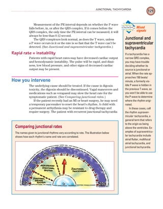 121
JUNCTIONAL TACHYCARDIA
Measurement of the PR interval depends on whether the P wave
falls before, in, or after the QRS complex. If it comes before the
QRS complex, the only time the PR interval can be measured, it will
always be less than 0.12 second.
The QRS complexes look normal, as does the T wave, unless
a P wave occurs in it or the rate is so fast that the T wave can’t be
detected. (See Junctional and supraventricular tachycardia.)
Rapid rate = instability
Patients with rapid heart rates may have decreased cardiac output
and hemodynamic instability. The pulse will be rapid, and dizzi-
ness, low blood pressure, and other signs of decreased cardiac
output may be present.
How you intervene
The underlying cause should be treated. If the cause is digoxin
toxicity, the digoxin should be discontinued. Vagal maneuvers and
medications such as verapamil may slow the heart rate for the
symptomatic patient. (See Comparing junctional rates.)
If the patient recently had an MI or heart surgery, he may need
a temporary pacemaker to reset the heart’s rhythm. A child with
a permanent arrhythmia may be resistant to drug therapy and
require surgery. The patient with recurrent junctional tachycardia
Junctional and
supraventricular
tachycardia
If a tachycardia has a
narrow QRS complex,
you may have trouble
deciding whether its
source is junctional or
atrial. When the rate ap-
proaches 150 beats/
minute, a formerly vis-
ible P wave is hidden in
the previous T wave, so
you won’t be able to use
the P wave to determine
where the rhythm origi-
nated.
In these cases, call
the rhythm supraven-
tricular tachycardia, a
general term that refers
to the origin as being
above the ventricles. Ex-
amples of supraventricu-
lar tachycardia include
atrial flutter, multifocal
atrial tachycardia, and
junctional tachycardia.
Mixed
signals
Comparing junctional rates
The names given to junctional rhythms vary according to rate. The illustration below
shows how each rhythm’s name and rate are correlated.
ECG_Chap06.indd 121
ECG_Chap06.indd 121 7/7/2010 5:57:03 PM
7/7/2010 5:57:03 PM
 
