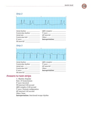 125
QUICK QUIZ
Strip 2
Atrial rhythm: ________________ QRS complex: ________________
Ventricular rhythm: ___________ T wave:______________________
Atrial rate: ___________________ QT interval: __________________
Ventricular rate: ______________ Other: _______________________
P wave:______________________ Interpretation: ______________
PR interval: __________________
Strip 3
Atrial rhythm: ________________ QRS complex: ________________
Ventricular rhythm: ___________ T wave:______________________
Atrial rate: ___________________ QT interval: __________________
Ventricular rate: ______________ Other: _______________________
P wave:______________________ Interpretation: ______________
PR interval: __________________
Answers to test strips
1. Rhythm: Regular
Rate: 47 beats/minute
P wave: Inverted
PR interval: 0.08 second
QRS complex: 0.06 second
T wave: Normal configuration
QT interval: 0.42 second
Other: None
Interpretation: Junctional escape rhythm
ECG_Chap06.indd 125
ECG_Chap06.indd 125 7/7/2010 5:57:06 PM
7/7/2010 5:57:06 PM
 