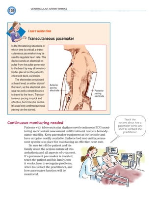 136
VENTRICULAR ARRHYTHMIAS
Continuous monitoring needed
Patients with idioventricular rhythms need continuous ECG moni-
toring and constant assessment until treatment restores hemody-
namic stability. Keep pacemaker equipment at the bedside and
have atropine readily available. Enforce bed rest until a perma-
nent system is in place for maintaining an effective heart rate.
Be sure to tell the patient and his
family about the serious nature of this
arrhythmia and all aspects of treatment.
If a permanent pacemaker is inserted,
teach the patient and his family how
it works, how to recognize problems,
when to contact the practitioner, and
how pacemaker function will be
monitored.
In life-threatening situations in
which time is critical, a trans-
cutaneous pacemaker may be
used to regulate heart rate. This
device sends an electrical im-
pulse from the pulse generator
to the heart by way of two elec-
trodes placed on the patient’s
chest and back, as shown.
The electrodes are placed
at heart level, on either side of
the heart, so the electrical stim-
ulus has only a short distance
to travel to the heart. Transcu-
taneous pacing is quick and
effective, but it may be painful.
It’s used only until transvenous
pacing can be started.
I can’t waste time
Transcutaneous pacemaker
Anterior
pacing
electrode Posterior
pacing
electrode
Teach the
patient about how a
pacemaker works and
when to contact the
practitioner.
ECG_Chap07.indd 136
ECG_Chap07.indd 136 7/7/2010 5:59:11 PM
7/7/2010 5:59:11 PM
 