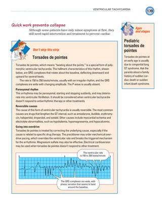 139
VENTRICULAR TACHYCARDIA
Quick work prevents collapse
Although some patients have only minor symptoms at first, they
still need rapid intervention and treatment to prevent cardiac
Torsades de pointes, which means “twisting about the points,” is a special form of poly-
morphic ventricular tachycardia. The hallmark characteristics of this rhythm, shown
below, are QRS complexes that rotate about the baseline, deflecting downward and
upward for several beats.
The rate is 150 to 250 beats/minute, usually with an irregular rhythm, and the QRS
complexes are wide with changing amplitude. The P wave is usually absent.
Paroxysmal rhythm
This arrhythmia may be paroxysmal, starting and stopping suddenly, and may deterio-
rate into ventricular fibrillation. It should be considered when ventricular tachycardia
doesn’t respond to antiarrhythmic therapy or other treatments.
Reversible causes
The cause of this form of ventricular tachycardia is usually reversible. The most common
causes are drugs that lengthen the QT interval, such as amiodarone, ibutilide, erythromy-
cin, haloperidol, droperidol, and sotalol. Other causes include myocardial ischemia and
electrolyte abnormalities, such as hypokalemia, hypomagnesemia, and hypocalcemia.
Going into overdrive
Torsades de pointes is treated by correcting the underlying cause, especially if the
cause is related to specific drug therapy. The practitioner may order mechanical over-
drive pacing, which overrides the ventricular rate and breaks the triggered mechanism
for the arrhythmia. Magnesium sulfate may also be effective. Electrical cardioversion
may be used when torsades de pointes doesn’t respond to other treatment.
Don’t skip this strip
Torsades de pointes
The ventricular rate
is 150 to 250 beats/minute.
The QRS complexes are wide, with
phasic variation that seems to twist
around the baseline.
Pediatric
torsades de
pointes
Torsades de pointes at
an early age is usually
due to congenital long
QT syndrome. Ask the
parents about a family
history of sudden car-
diac death or sudden
infant death syndrome.
Ages
and stages
ECG_Chap07.indd 139
ECG_Chap07.indd 139 7/7/2010 5:59:13 PM
7/7/2010 5:59:13 PM
 
