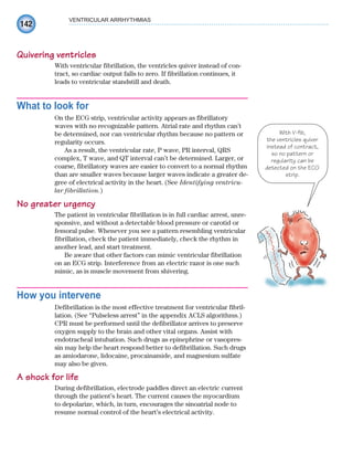 142
VENTRICULAR ARRHYTHMIAS
Quivering ventricles
With ventricular fibrillation, the ventricles quiver instead of con-
tract, so cardiac output falls to zero. If fibrillation continues, it
leads to ventricular standstill and death.
What to look for
On the ECG strip, ventricular activity appears as fibrillatory
waves with no recognizable pattern. Atrial rate and rhythm can’t
be determined, nor can ventricular rhythm because no pattern or
regularity occurs.
As a result, the ventricular rate, P wave, PR interval, QRS
complex, T wave, and QT interval can’t be determined. Larger, or
coarse, fibrillatory waves are easier to convert to a normal rhythm
than are smaller waves because larger waves indicate a greater de-
gree of electrical activity in the heart. (See Identifying ventricu-
lar fibrillation.)
No greater urgency
The patient in ventricular fibrillation is in full cardiac arrest, unre-
sponsive, and without a detectable blood pressure or carotid or
femoral pulse. Whenever you see a pattern resembling ventricular
fibrillation, check the patient immediately, check the rhythm in
another lead, and start treatment.
Be aware that other factors can mimic ventricular fibrillation
on an ECG strip. Interference from an electric razor is one such
mimic, as is muscle movement from shivering.
How you intervene
Defibrillation is the most effective treatment for ventricular fibril-
lation. (See “Pulseless arrest” in the appendix ACLS algorithms.)
CPR must be performed until the defibrillator arrives to preserve
oxygen supply to the brain and other vital organs. Assist with
endotracheal intubation. Such drugs as epinephrine or vasopres-
sin may help the heart respond better to defibrillation. Such drugs
as amiodarone, lidocaine, procainamide, and magnesium sulfate
may also be given.
A shock for life
During defibrillation, electrode paddles direct an electric current
through the patient’s heart. The current causes the myocardium
to depolarize, which, in turn, encourages the sinoatrial node to
resume normal control of the heart’s electrical activity.
With V-fib,
the ventricles quiver
instead of contract,
so no pattern or
regularity can be
detected on the ECG
strip.
ECG_Chap07.indd 142
ECG_Chap07.indd 142 7/7/2010 5:59:15 PM
7/7/2010 5:59:15 PM
 