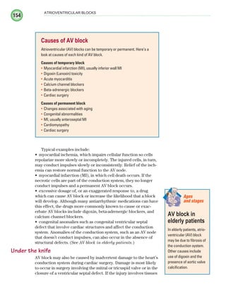 154
ATRIOVENTRICULAR BLOCKS
Typical examples include:
myocardial ischemia, which impairs cellular function so cells
•
repolarize more slowly or incompletely. The injured cells, in turn,
may conduct impulses slowly or inconsistently. Relief of the isch-
emia can restore normal function to the AV node.
myocardial infarction (MI), in which cell death occurs. If the
•
necrotic cells are part of the conduction system, they no longer
conduct impulses and a permanent AV block occurs.
excessive dosage of, or an exaggerated response to, a drug
•
which can cause AV block or increase the likelihood that a block
will develop. Although many antiarrhythmic medications can have
this effect, the drugs more commonly known to cause or exac-
erbate AV blocks include digoxin, beta-adrenergic blockers, and
calcium channel blockers.
congenital anomalies such as congenital ventricular septal
•
defect that involve cardiac structures and affect the conduction
system. Anomalies of the conduction system, such as an AV node
that doesn’t conduct impulses, can also occur in the absence of
structural defects. (See AV block in elderly patients.)
Under the knife
AV block may also be caused by inadvertent damage to the heart’s
conduction system during cardiac surgery. Damage is most likely
to occur in surgery involving the mitral or tricuspid valve or in the
closure of a ventricular septal defect. If the injury involves tissues
Causes of AV block
Atrioventricular (AV) blocks can be temporary or permanent. Here’s a
look at causes of each kind of AV block.
Causes of temporary block
Myocardial infarction (MI), usually inferior wall MI
•
Digoxin (Lanoxin) toxicity
•
Acute myocarditis
•
Calcium channel blockers
•
Beta-adrenergic blockers
•
Cardiac surgery
•
Causes of permanent block
Changes associated with aging
•
Congenital abnormalities
•
MI, usually anteroseptal MI
•
Cardiomyopathy
•
Cardiac surgery
•
AV block in
elderly patients
In elderly patients, atrio-
ventricular (AV) block
may be due to fibrosis of
the conduction system.
Other causes include
use of digoxin and the
presence of aortic valve
calcification.
Ages
and stages
ECG_Chap08.indd 154
ECG_Chap08.indd 154 7/8/2010 4:27:50 PM
7/8/2010 4:27:50 PM
 