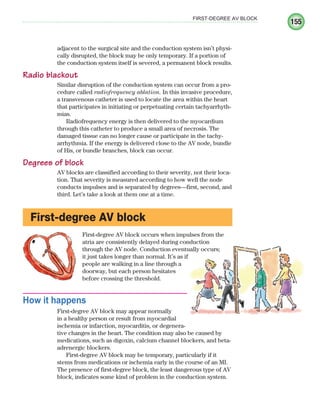 155
FIRST-DEGREE AV BLOCK
adjacent to the surgical site and the conduction system isn’t physi-
cally disrupted, the block may be only temporary. If a portion of
the conduction system itself is severed, a permanent block results.
Radio blackout
Similar disruption of the conduction system can occur from a pro-
cedure called radiofrequency ablation. In this invasive procedure,
a transvenous catheter is used to locate the area within the heart
that participates in initiating or perpetuating certain tachyarrhyth-
mias.
Radiofrequency energy is then delivered to the myocardium
through this catheter to produce a small area of necrosis. The
damaged tissue can no longer cause or participate in the tachy-
arrhythmia. If the energy is delivered close to the AV node, bundle
of His, or bundle branches, block can occur.
Degrees of block
AV blocks are classified according to their severity, not their loca-
tion. That severity is measured according to how well the node
conducts impulses and is separated by degrees—first, second, and
third. Let’s take a look at them one at a time.
First-degree AV block
First-degree AV block occurs when impulses from the
atria are consistently delayed during conduction
through the AV node. Conduction eventually occurs;
it just takes longer than normal. It’s as if
people are walking in a line through a
doorway, but each person hesitates
before crossing the threshold.
How it happens
First-degree AV block may appear normally
in a healthy person or result from myocardial
ischemia or infarction, myocarditis, or degenera-
tive changes in the heart. The condition may also be caused by
medications, such as digoxin, calcium channel blockers, and beta-
adrenergic blockers.
First-degree AV block may be temporary, particularly if it
stems from medications or ischemia early in the course of an MI.
The presence of first-degree block, the least dangerous type of AV
block, indicates some kind of problem in the conduction system.
ECG_Chap08.indd 155
ECG_Chap08.indd 155 7/8/2010 4:27:51 PM
7/8/2010 4:27:51 PM
 
