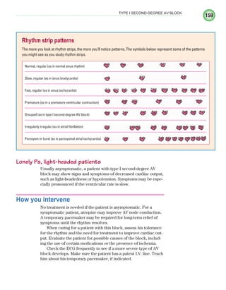 159
TYPE I SECOND-DEGREE AV BLOCK
Lonely Ps, light-headed patients
Usually asymptomatic, a patient with type I second-degree AV
block may show signs and symptoms of decreased cardiac output,
such as light-headedness or hypotension. Symptoms may be espe-
cially pronounced if the ventricular rate is slow.
How you intervene
No treatment is needed if the patient is asymptomatic. For a
symptomatic patient, atropine may improve AV node conduction.
A temporary pacemaker may be required for long-term relief of
symptoms until the rhythm resolves.
When caring for a patient with this block, assess his tolerance
for the rhythm and the need for treatment to improve cardiac out-
put. Evaluate the patient for possible causes of the block, includ-
ing the use of certain medications or the presence of ischemia.
Check the ECG frequently to see if a more severe type of AV
block develops. Make sure the patient has a patent I.V. line. Teach
him about his temporary pacemaker, if indicated.
Rhythm strip patterns
The more you look at rhythm strips, the more you’ll notice patterns. The symbols below represent some of the patterns
you might see as you study rhythm strips.
Normal, regular (as in normal sinus rhythm)
Slow, regular (as in sinus bradycardia)
Fast, regular (as in sinus tachycardia)
Premature (as in a premature ventricular contraction)
Grouped (as in type I second-degree AV block)
Irregularly irregular (as in atrial fibrillation)
Paroxysm or burst (as in paroxysmal atrial tachycardia)
ECG_Chap08.indd 159
ECG_Chap08.indd 159 7/8/2010 4:27:54 PM
7/8/2010 4:27:54 PM
 