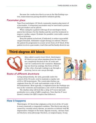 163
THIRD-DEGREE AV BLOCK
Because the conduction block occurs in the His-Purkinje sys-
tem, transcutaneous pacing should be initiated quickly.
Pacemaker place
Type II second-degree AV block commonly requires placement of
a pacemaker. A temporary pacemaker may be used until a perma-
nent pacemaker can be placed.
When caring for a patient with type II second-degree block,
assess his tolerance for the rhythm and the need for treatment to
improve cardiac output. Evaluate for possible correctable causes
such as ischemia.
Keep the patient on bed rest, if indicated, to reduce myocardial
oxygen demands. Administer oxygen therapy as ordered. Observe
the patient for progression to a more severe form of AV block. If the
patient receives a pacemaker, teach him and his family about its use.
Third-degree AV block
Also called complete heart block, third-degree
AV block occurs when impulses from the atria
are completely blocked at the AV node and
can’t be conducted to the ventricles. Maintain-
ing our doorway analogy, this form of block
is like a line of people waiting to go through a
doorway, but no one can go through.
Beats of different drummers
Acting independently, the atria, generally under the
control of the SA node, tend to maintain a regular rate
of 60 to 100 beats/minute. The ventricular rhythm can
originate from the AV node and maintain a rate of 40 to
60 beats/minute. Most typically, it originates from the Purkinje sys-
tem in the ventricles and maintains a rate of 20 to 40 beats/minute.
The rhythm strip will look like a strip of P waves laid inde-
pendently over a strip of QRS complexes. Note that the P wave
doesn’t conduct the QRS complex that follows it.
How it happens
Third-degree AV block that originates at the level of the AV node
is most commonly a congenital condition. This block may also be
caused by coronary artery disease, an anterior or inferior wall MI,
degenerative changes in the heart, digoxin toxicity, calcium chan-
nel blockers, beta-adrenergic blockers, or surgical injury. It may
ECG_Chap08.indd 163
ECG_Chap08.indd 163 7/8/2010 4:27:57 PM
7/8/2010 4:27:57 PM
 