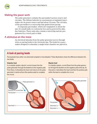 176
NONPHARMACOLOGIC TREATMENTS
Making the pacer work
The pulse generator contains the pacemaker’s power source and
circuitry. The lithium batteries in a permanent or implanted pace-
maker are its power source and last about 10 years. The circuitry
of the pacemaker is a microchip that guides heart pacing.
A temporary pacemaker, which isn’t implanted, is about the
size of a small radio or a telemetry box and is powered by alka-
line batteries. These units also contain a microchip and are pro-
grammed by a touch pad or dials.
A stimulus on the move
An electrical stimulus from the pulse generator moves through
wires or pacing leads to the electrode tips. The leads for a pace-
maker designed to stimulate a single heart chamber are placed in
A look at pacing leads
Pacing leads have either one electrode (unipolar) or two (bipolar). These illustrations show the difference between the
two leads.
Unipolar lead
In a unipolar system, electric current moves from the
pulse generator through the leadwire to the negative pole.
From there, it stimulates the heart and returns to the pulse
generator’s metal surface (the positive pole) to complete
the circuit.
Bipolar lead
In a bipolar system, current flows from the pulse genera-
tor through the leadwire to the negative pole at the tip. At
that point, it stimulates the heart and then the positive pole
within the lead to complete the circuit.
Pulse generator (+)
Pacing lead
Direction of current flow
Electrode (–)
Pacing lead
Electrode (–)
Electrode (+)
From pulse generator
ECG_Chap09.indd 176
ECG_Chap09.indd 176 7/8/2010 4:31:00 PM
7/8/2010 4:31:00 PM
 