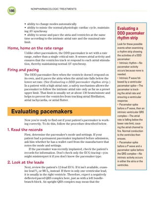 186
NONPHARMACOLOGIC TREATMENTS
ability to change modes automatically
•
ability to mimic the normal physiologic cardiac cycle, maintain-
•
ing AV synchrony
ability to sense and pace the atria and ventricles at the same
•
time according to the intrinsic atrial rate and the maximal rate
limit.
Home, home on the rate range
Unlike other pacemakers, the DDD pacemaker is set with a rate
range, rather than a single critical rate. It senses atrial activity and
ensures that the ventricles track or respond to each atrial stimula-
tion, thereby maintaining normal AV synchrony.
Firing and pacing
The DDD pacemaker fires when the ventricle doesn’t respond on
its own, and it paces the atria when the atrial rate falls below the
lower set rate. (See Evaluating a DDD pacemaker rhythm strip.)
In a patient with a high atrial rate, a safety mechanism allows the
pacemaker to follow the intrinsic atrial rate only as far as a preset
upper limit. That limit is usually set at about 130 beats/minute and
helps to prevent the ventricles from tracking atrial fibrillation,
atrial tachycardia, or atrial flutter.
Evaluating pacemakers
Now you’re ready to find out if your patient’s pacemaker is work-
ing correctly. To do this, follow the procedure described below.
1. Read the records
First, determine the pacemaker’s mode and settings. If your
patient had a permanent pacemaker implanted before admission,
ask him whether he has a wallet card from the manufacturer that
notes the mode and settings.
If the pacemaker was recently implanted, check the patient’s
records for information. Don’t check only the ECG tracing—you
might misinterpret it if you don’t know the pacemaker type.
2. Look at the leads
Next, review the patient’s 12-lead ECG. If it isn’t available, exam-
ine lead V1 or MCL1 instead. If there is only one ventricular lead,
it is usually in the right ventricle. Therefore, expect a negatively
deflected paced QRS complex here, just as with a left bundle-
branch block. An upright QRS complex may mean that the
Evaluating a
DDD pacemaker
rhythm strip
Look for these possible
events when examining
a rhythm strip showing
the activities of a DDD
pacemaker:
Intrinsic rhythm—No
•
pacemaker activity
occurs because none is
needed.
Intrinsic P wave fol-
•
lowed by a ventricular
pacemaker spike—The
pacemaker is track-
ing the atrial rate and
ensuring a ventricular
response.
Pacemaker spike
•
before a P wave, then an
intrinsic ventricular QRS
complex—The atrial
rate is falling below the
lower rate limit, caus-
ing the atrial channel to
fire. Normal conduction
to the ventricles then
ensues.
Pacemaker spike
•
before a P wave and a
pacemaker spike before
the QRS complex—No
intrinsic activity occurs
in either the atria or the
ventricles.
ECG_Chap09.indd 186
ECG_Chap09.indd 186 7/8/2010 4:31:07 PM
7/8/2010 4:31:07 PM
 