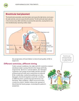 192
NONPHARMACOLOGIC TREATMENTS
the progression of heart failure is slowed and quality of life is
improved.
Different ventricles, different timing
Under normal conditions, the right and left ventricles contract
simultaneously to pump blood to the lungs and body,
respectively. However, in heart failure, the damaged
ventricles can’t pump as forcefully and the amount
of blood ejected with each contraction is reduced.
If the ventricular conduction pathways are also
damaged, electrical impulses reach the ventricles
at different times, producing asynchronous con-
tractions. This condition, called intraventricular
conduction defect, further reduces the amount of
blood that the heart pumps, worsening the patient’s
symptoms.
Biventricular lead placement
The biventricular pacemaker uses three leads: one to pace the right atrium, one to pace
the right ventricle, and one to pace the left ventricle. The left ventricular lead is placed
in the coronary sinus. Both ventricles are paced at the same time, causing them to con-
tract simultaneously, improving cardiac output.
Generator
Right atrial lead
Right atrium
Right ventricular lead
Right ventricle
Subclavian vein
Left ventricular lead
(in coronary sinus vein)
Left ventricle
Biventricular
pacing produces
an improvement
in quality of life.
ECG_Chap09.indd 192
ECG_Chap09.indd 192 7/8/2010 4:31:11 PM
7/8/2010 4:31:11 PM
 