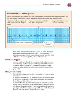 209
ANTIARRHYTHMICS BY CLASS
then 200 to 300 mg orally every 4 to 6 hours, or 300 to 600 mg of
extended-release quinidine sulfate every 8 to 12 hours. For I.V.
administration, give 800 mg of quinidine gluconate added to 40 ml
of dextrose 5% in water (D5W), infused at 1 ml/minute.
What can happen
Adverse cardiovascular effects of quinidine include hypotension,
cardiotoxicity, VT, ECG changes (widening of the QRS complex,
widened QT and PR intervals), torsades de pointes, AV block,
and heart failure. (See Noncardiac adverse effects of quinidine,
page 210.)
How you intervene
Keep the following points in mind when caring for a patient taking
quinidine:
Monitor the patient’s ECG, heart rate, and blood pressure close-
•
ly. Don’t give more than 4 g/day. Adjust dosages in patients with
heart failure and liver disease.
Obtain a baseline QT-interval measurement before the patient
•
begins therapy. Watch for and notify the practitioner if the patient
develops prolongation of the QT interval, a sign that the patient is
predisposed to developing polymorphic VT. Also notify the practi-
tioner if the QRS complex widens by 25% or more.
Effects of class Ia antiarrhythmics
Class Ia antiarrhythmic drugs—including such drugs as quinidine and procainamide—affect the cardiac cycle in spe-
cific ways and lead to specific ECG changes, as shown on the rhythm strip below. Class Ia antiarrhythmics:
block sodium influx during phase 0,
•
which depresses the rate of depolar-
ization
prolong repolarization and the dura-
•
tion of the action potential
lengthen the refractory period
•
decrease contractility.
•
The QRS complex is slightly widened. The QT interval is
prolonged.
ECG_Chap10.indd 209
ECG_Chap10.indd 209 7/7/2010 6:03:27 PM
7/7/2010 6:03:27 PM
 