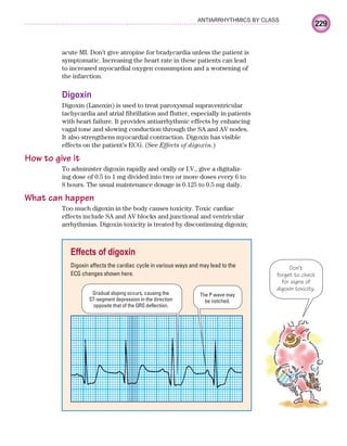 229
ANTIARRHYTHMICS BY CLASS
acute MI. Don’t give atropine for bradycardia unless the patient is
symptomatic. Increasing the heart rate in these patients can lead
to increased myocardial oxygen consumption and a worsening of
the infarction.
Digoxin
Digoxin (Lanoxin) is used to treat paroxysmal supraventricular
tachycardia and atrial fibrillation and flutter, especially in patients
with heart failure. It provides antiarrhythmic effects by enhancing
vagal tone and slowing conduction through the SA and AV nodes.
It also strengthens myocardial contraction. Digoxin has visible
effects on the patient’s ECG. (See Effects of digoxin.)
How to give it
To administer digoxin rapidly and orally or I.V., give a digitaliz-
ing dose of 0.5 to 1 mg divided into two or more doses every 6 to
8 hours. The usual maintenance dosage is 0.125 to 0.5 mg daily.
What can happen
Too much digoxin in the body causes toxicity. Toxic cardiac
effects include SA and AV blocks and junctional and ventricular
arrhythmias. Digoxin toxicity is treated by discontinuing digoxin;
Don’t
forget to check
for signs of
digoxin toxicity.
Effects of digoxin
Digoxin affects the cardiac cycle in various ways and may lead to the
ECG changes shown here.
The P wave may
be notched.
Gradual sloping occurs, causing the
ST-segment depression in the direction
opposite that of the QRS deflection.
ECG_Chap10.indd 229
ECG_Chap10.indd 229 7/7/2010 6:03:35 PM
7/7/2010 6:03:35 PM
 