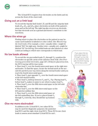 244
OBTAINING A 12-LEAD ECG
The 12-lead ECG requires four electrodes on the limbs and six
across the front of the chest wall.
Going out on a limb lead
To record the bipolar limb leads I, II, and III and the unipolar limb
leads aVR, aVL, and aVF, place electrodes on both of the patient’s
arms and on his left leg. The right leg also receives an electrode,
but that electrode acts as a ground and doesn’t contribute to the
waveform.
Where the wires go
Finding where to place the electrodes on the patient is easy be-
cause each leadwire is labeled or color coded. (See Monitoring
the limb leads.) For example, a wire—usually white—might be
labeled “RA” for right arm. Another wire—usually red—might be
labeled “LL” for left leg. Precordial leads are also labeled or color
coded according to which wire corresponds to which lead.
No low leads allowed
To record the six precordial leads (V1 through V6), position the
electrodes on specific areas of the anterior chest wall. (See Posi-
tioning precordial electrodes, page 247.) If they’re placed too low,
the ECG tracing will be inaccurate.
Place lead V
• 1 over the fourth intercostal space at the right ster-
nal border. To find the space, locate the sternal notch at the sec-
ond rib and feel your way down along the sternal border until you
reach the fourth intercostal space.
Place lead V
• 2 just opposite V1, over the fourth intercostal space
at the left sternal border.
Place lead V
• 3 midway between V2 and V4. Tip: Placing lead V4
before lead V3 makes it easier to see where to place lead V3.
Place lead V
• 4 over the fifth intercostal space at the left mid-
clavicular line.
Place lead V
• 5 over the fifth intercostal space at the
left anterior axillary line.
Place lead V
• 6 over the fifth intercostal space at
the left midaxillary line. If you’ve placed leads V4
through V6 correctly, they should line up horizon-
tally.
Give me more electrodes!
In addition to the 12-lead ECG, two other ECGs
may be used for diagnostic purposes: the posterior-
lead ECG and the right chest–lead ECG. These ECGs use chest
leads to assess areas standard 12-lead ECGs can’t.
If you place the six
precordial leads (V1
through V6) too low
on the anterior chest
wall, the ECG tracing
will be inaccurate.
ECG_Chap11.indd 244
ECG_Chap11.indd 244 7/8/2010 4:33:21 PM
7/8/2010 4:33:21 PM
 