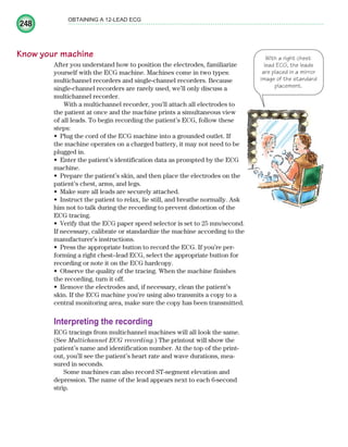248
OBTAINING A 12-LEAD ECG
Know your machine
After you understand how to position the electrodes, familiarize
yourself with the ECG machine. Machines come in two types:
multichannel recorders and single-channel recorders. Because
single-channel recorders are rarely used, we’ll only discuss a
multichannel recorder.
With a multichannel recorder, you’ll attach all electrodes to
the patient at once and the machine prints a simultaneous view
of all leads. To begin recording the patient’s ECG, follow these
steps:
Plug the cord of the ECG machine into a grounded outlet. If
•
the machine operates on a charged battery, it may not need to be
plugged in.
Enter the patient’s identification data as prompted by the ECG
•
machine.
Prepare the patient’s skin, and then place the electrodes on the
•
patient’s chest, arms, and legs.
Make sure all leads are securely attached.
•
Instruct the patient to relax, lie still, and breathe normally. Ask
•
him not to talk during the recording to prevent distortion of the
ECG tracing.
Verify that the ECG paper speed selector is set to 25 mm/second.
•
If necessary, calibrate or standardize the machine according to the
manufacturer’s instructions.
Press the appropriate button to record the ECG. If you’re per-
•
forming a right chest–lead ECG, select the appropriate button for
recording or note it on the ECG hardcopy.
Observe the quality of the tracing. When the machine finishes
•
the recording, turn it off.
Remove the electrodes and, if necessary, clean the patient’s
•
skin. If the ECG machine you're using also transmits a copy to a
central monitoring area, make sure the copy has been transmitted.
Interpreting the recording
ECG tracings from multichannel machines will all look the same.
(See Multichannel ECG recording.) The printout will show the
patient’s name and identification number. At the top of the print-
out, you’ll see the patient’s heart rate and wave durations, mea-
sured in seconds.
Some machines can also record ST-segment elevation and
depression. The name of the lead appears next to each 6-second
strip.
With a right chest
lead ECG, the leads
are placed in a mirror
image of the standard
placement.
ECG_Chap11.indd 248
ECG_Chap11.indd 248 7/8/2010 4:33:31 PM
7/8/2010 4:33:31 PM
 