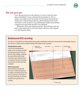 249
A LOOK AT THE 12-LEAD ECG
Get out your pen
If not already present on the printout, be sure to write the date,
time, practitioner’s name, and special circumstances. For ex-
ample, you might record an episode of chest pain, abnormal elec-
trolyte level, related drug treatment, abnormal placement of the
electrodes, or the presence of an artificial pacemaker and whether
a magnet was used while the ECG was obtained.
Remember, ECGs are legal documents. They belong on the pa-
tient’s chart and must be saved for future reference and compari-
son with baseline strips.
Multichannel ECG recording
The top of a 12-lead ECG recording usually shows patient identification information along with the interpretation done by
the machine. A rhythm strip is usually included at the bottom of the recording.
Standardization marks
Look for the standardization
marks on the recording, normally
10 small squares high. If the pa-
tient has high voltage complexes,
the marks will be half as high.
You’ll also notice that lead mark-
ers separate the lead recordings
on the paper and that each lead
is labeled.
ECG tracing layout
Also familiarize yourself with
the order in which the leads are
arranged on the ECG tracing. Get-
ting accustomed to the layout of
the tracing will help you interpret
the ECG more quickly and ac-
curately.
Standardization
mark
Lead marker
Patient and
ECG information
Rhythm strip
Lead name
ECG_Chap11.indd 249
ECG_Chap11.indd 249 7/8/2010 4:33:32 PM
7/8/2010 4:33:32 PM
 