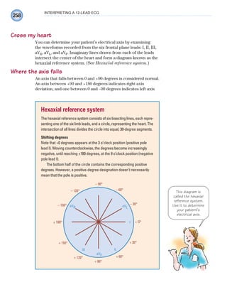 258
INTERPRETING A 12-LEAD ECG
Cross my heart
You can determine your patient’s electrical axis by examining
the waveforms recorded from the six frontal plane leads: I, II, III,
aVR, aVL, and aVF. Imaginary lines drawn from each of the leads
intersect the center of the heart and form a diagram known as the
hexaxial reference system. (See Hexaxial reference system.)
Where the axis falls
An axis that falls between 0 and +90 degrees is considered normal.
An axis between +90 and +180 degrees indicates right axis
deviation, and one between 0 and –90 degrees indicates left axis
Hexaxial reference system
The hexaxial reference system consists of six bisecting lines, each repre-
senting one of the six limb leads, and a circle, representing the heart. The
intersection of all lines divides the circle into equal, 30-degree segments.
Shifting degrees
Note that +0 degrees appears at the 3 o’clock position (positive pole
lead I). Moving counterclockwise, the degrees become increasingly
negative, until reaching ±180 degrees, at the 9 o’clock position (negative
pole lead I).
The bottom half of the circle contains the corresponding positive
degrees. However, a positive-degree designation doesn’t necessarily
mean that the pole is positive.
This diagram is
called the hexaxial
reference system.
Use it to determine
your patient’s
electrical axis.
– 90°
aVL
aVR
I
II
III
– 60°
– 30°
+ 30°
+ 60°
+ 90°
+ 120°
+ 150°
– 150°
– 120°
± 180° + O°
aVF
ECG_Chap12.indd 258
ECG_Chap12.indd 258 7/8/2010 4:37:06 PM
7/8/2010 4:37:06 PM
 