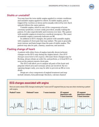 263
DISORDERS AFFECTING A 12-LEAD ECG
Stable or unstable?
You may hear the term stable angina applied to certain conditions
and unstable angina applied to others. In stable angina, pain is
triggered by exertion or stress and is usually relieved by rest. Each
episode follows the same pattern.
Unstable angina, which is one of the components of acute
coronary syndrome, is more easily provoked, usually waking the
patient. It’s also unpredictable and worsens over time. The patient
with unstable angina is treated as a medical emergency. The onset
of unstable angina commonly indicates an MI.
In addition to ECG changes, the patient with unstable angina
will complain of chest pain that may radiate. The pain is generally
more intense and lasts longer than the pain of stable angina. The
patient may also be pale, clammy, nauseous, and anxious.
Fleeting change of heart
A patient with either form of angina typically shows ischemic
changes on the ECG only during the angina attack. (See ECG
changes associated with angina.) Because these changes may be
fleeting, always obtain an order for, and perform, a 12-lead ECG as
soon as the patient reports chest pain.
The ECG will allow you to analyze all parts of the heart and
pinpoint which area and coronary artery are involved. By rec-
ognizing danger early, you may be able to prevent an MI or even
death.
Drugs are a key component of anginal treatment and may
include nitrates, beta-adrenergic blockers, calcium channel
ECG changes associated with angina
Here are some classic ECG changes involving the T wave and ST segment that you may see when monitoring a patient
with angina.
Peaked T wave Flattened T wave T-wave inversion ST-segment
depression with
T-wave inversion
ST-segment
depression without
T-wave inversion
ECG_Chap12.indd 263
ECG_Chap12.indd 263 7/8/2010 4:37:15 PM
7/8/2010 4:37:15 PM
 