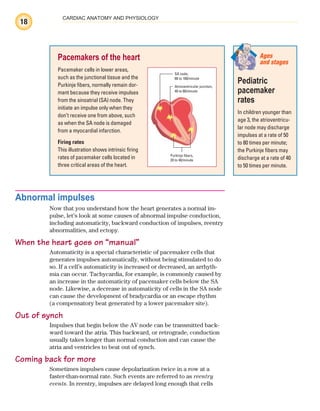 18
CARDIAC ANATOMY AND PHYSIOLOGY
Abnormal impulses
Now that you understand how the heart generates a normal im-
pulse, let’s look at some causes of abnormal impulse conduction,
including automaticity, backward conduction of impulses, reentry
abnormalities, and ectopy.
When the heart goes on “manual”
Automaticity is a special characteristic of pacemaker cells that
generates impulses automatically, without being stimulated to do
so. If a cell’s automaticity is increased or decreased, an arrhyth-
mia can occur. Tachycardia, for example, is commonly caused by
an increase in the automaticity of pacemaker cells below the SA
node. Likewise, a decrease in automaticity of cells in the SA node
can cause the development of bradycardia or an escape rhythm
(a compensatory beat generated by a lower pacemaker site).
Out of synch
Impulses that begin below the AV node can be transmitted back-
ward toward the atria. This backward, or retrograde, conduction
usually takes longer than normal conduction and can cause the
atria and ventricles to beat out of synch.
Coming back for more
Sometimes impulses cause depolarization twice in a row at a
faster-than-normal rate. Such events are referred to as reentry
events. In reentry, impulses are delayed long enough that cells
Pacemakers of the heart
Pacemaker cells in lower areas,
such as the junctional tissue and the
Purkinje fibers, normally remain dor-
mant because they receive impulses
from the sinoatrial (SA) node. They
initiate an impulse only when they
don’t receive one from above, such
as when the SA node is damaged
from a myocardial infarction.
Firing rates
This illustration shows intrinsic firing
rates of pacemaker cells located in
three critical areas of the heart.
SA node,
60 to 100/minute
Atrioventricular junction,
40 to 60/minute
Purkinje fibers,
20 to 40/minute
Pediatric
pacemaker
rates
In children younger than
age 3, the atrioventricu-
lar node may discharge
impulses at a rate of 50
to 80 times per minute;
the Purkinje fibers may
discharge at a rate of 40
to 50 times per minute.
Ages
and stages
ECG_Chap01.indd 18
ECG_Chap01.indd 18 7/7/2010 5:47:54 PM
7/7/2010 5:47:54 PM
 