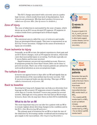 270
INTERPRETING A 12-LEAD ECG
The ECG change associated with a necrotic area is a patho-
logic Q wave, which results from lack of depolarization. Such
Q waves are permanent. MIs that don’t produce Q waves are
called non–Q-wave MIs. (See Q waves in children.)
Zone of injury
The zone of infarction is surrounded by the zone of injury, which
shows up on an ECG as an elevated ST segment. ST-segment el-
evation results from a prolonged lack of blood supply.
Zone of ischemia
The outermost area is called the zone of ischemia and results
from an interrupted blood supply. This zone is represented on an
ECG by T-wave inversion. Changes in the zones of ischemia or
injury are reversible.
From ischemia to injury
Generally, as an MI occurs, the patient experiences chest pain and
an ECG shows changes, such as ST-segment elevation, which indi-
cates that myocardial injury is occurring. You’ll also typically see
T waves flatten and become inverted.
Rapid treatment can prevent myocardial necrosis. However,
if symptoms persist for more than 6 hours, little can be done to
prevent necrosis. That’s one of the reasons patients are advised to
seek medical attention as soon as symptoms begin.
The telltale Q wave
Q waves can appear hours to days after an MI and signify that an
entire thickness of the myocardium has become necrotic. Tall
R waves in reciprocal leads can also develop. This type of MI is
called a transmural, or Q-wave, MI.
Back to baseline
Knowing how long such changes last can help you determine how
long ago an MI occurred. ST segments return to baseline within
a few days to 2 weeks. Inverted T waves may persist for several
months. Although not every patient who has had an MI develops
Q waves, those who do may have them on their ECGs indefinitely.
What to do for an MI
The most important step you can take for a patient with an MI is
to remain vigilant about detecting changes in his condition and in
his ECG. (See Monitoring MI patients.)
The primary goal of treatment for an MI is to limit the size of
the infarction by decreasing cardiac workload and increasing oxy-
gen supply to the myocardium. (See Improving blood flow.)
Q waves in
children
Q waves in leads II, III,
aVF, V5, and V6 are nor-
mal in children. Q waves
in other leads suggest
cardiac disease, such as
an abnormal left coro-
nary artery.
Ages
and stages
Monitoring MI
patients
Remember that specific
leads monitor specific
walls of the heart. Here’s
a quick overview of
those leads:
For an anterior wall
•
myocardial infarction
(MI), monitor lead V1 or
MCL1.
For a septal wall MI,
•
monitor lead V1 or MCL1
to pick up hallmark
changes.
For a lateral wall MI,
•
monitor lead V6 or MCL6.
For an inferior wall MI,
•
monitor lead II.
Mixed
signals
ECG_Chap12.indd 270
ECG_Chap12.indd 270 7/8/2010 4:37:38 PM
7/8/2010 4:37:38 PM
 