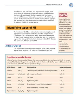 271
IDENTIFYING TYPES OF MI
In addition to rest, pain relief, and supplemental oxygen, such
medications as nitroglycerin, morphine sulfate, beta-adrenergic
blockers, calcium channel blockers, angiotensin-converting
enzyme inhibitors, and antiarrhythmics are used. Aspirin or glyco-
protein IIb/IIIa inhibitors may be used to reduce platelet aggrega-
tion. Thrombolytic therapy may also be prescribed to dissolve a
thrombus occluding a coronary artery.
Identifying types of MI
The location of the MI is a critical factor in determining the most
appropriate treatment and predicting probable complications.
Characteristic ECG changes that occur with each type of MI are
localized to the leads overlying the infarction site. (See Locating
myocardial damage.) Here’s a look at characteristic ECG changes
that occur with different types of MI.
Anterior wall MI
The left anterior descending artery supplies blood to the anterior
portion of the left ventricle. The artery supplies blood to the
Improving
blood flow
Increasing the blood
supply to the heart of a
patient who has had a
myocardial infarction
can help prevent further
damage to his heart. In
addition to medications,
blood flow to the heart
can be improved by:
intra-aorticballoonpump
•
percutaneous trans-
•
luminal coronary angio-
plasty
atherectomy
•
laser treatment
•
stent placement
•
coronary artery by-
•
pass graft.
Locating myocardial damage
After you’ve noted characteristic lead changes of an acute myocardial infarction, use this chart to identify the areas of
damage. Match the lead changes in the second column with the affected wall in the first column and the artery involved
in the third column. Column four shows reciprocal lead changes.
Wall affected
Anterior
Anterolateral
Septal
Inferior
Lateral
Posterior
Right ventricular
Leads
V2 to V4
I, aVL, V3 to V6
V1 to V2
II, III, aVF
I, aVL, V5, V6
V8, V9
V4R,V5R,V6R
Artery involved
Left coronary artery, left anterior descending (LAD) artery
LAD artery, circumflex artery
LAD artery
Right coronary artery
Circumflex artery, branch of left coronary artery
Right coronary artery, circumflex artery
Right coronary artery
Reciprocal changes
II, III, aVF
II, III, aVF
None
I, aVL
II, III, aVF
V1 to V4
None
ECG_Chap12.indd 271
ECG_Chap12.indd 271 7/8/2010 4:37:39 PM
7/8/2010 4:37:39 PM
 