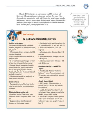 279
IDENTIFYING TYPES OF MI
Classic ECG changes in a posterior wall MI include tall
R waves, ST-segment depression, and upright T waves. (See
Recognizing a posterior wall MI.) Posterior infarctions usually
accompany inferior infarctions. Information about the posterior
wall and pathologic Q waves that might occur can be obtained
from leads V7 to V9 using a posterior ECG.
Looking at the waves
P waves:
• Upright; possibly inverted in
lead aVR or biphasic or inverted in leads III,
aVL, and V1
PR intervals:
• Always constant, like QRS-
complex durations
QRS-complex deflections:
• Variable in
different leads
Q waves:
• Possibly pathologic; duration
of less than 0.4 second when normal
T wave:
• Slightly rounded and upright;
normal deflection upward in leads I, II,
and V3 through V6; inverted in leads
III, aVF, aVR, aVL, and V1; shouldn’t be tall,
peaked, or notched
ST segments:
• should be isoelectric or
have minimal deviation
Electrical axis
Average direction of the heart’s elec-
•
trical activity during ventricular depo-
larization
Methods of determining axis
Quadrant method:
• Determines main
deflection of QRS complex in leads I and
aVF
Degree method:
• Identifies axis by
degrees on the hexaxial system
Examination of the waveforms from the
•
six frontal leads: I, II, III, aVR, aVL, and aVF
Normal axis:
• Between 0 and +90
degrees
Left axis deviation:
• Between 0 and –90
degrees
Right axis deviation:
• Between +90 and
+180 degrees
Extreme axis deviation:
• Between –180
and –90 degrees
Disorders affecting 12-lead ECGs
Angina
Possible ECG changes:
• Peaked or
flattened T wave, T-wave inversion, and
ST-segment depression with or without
T-wave inversion
Bundle-branch block
QRS complex:
• Width increases to
greater than 0.12 second with bundle-
branch block
Lead V
• 1 (to right of heart) and V6 (to
left of heart): Used to determine whether
block is in right or left bundle
RBBB:
• QRS complex has rsR’ pattern
and T-wave inversion in lead V1 and
widened S wave and upright T wave in
lead V6
That’s a wrap!
12-lead ECG interpretation review
(continued)
Identifying a right
ventricular MI is
difficult without the
right information
from the right
percordial leads.
ECG_Chap12.indd 279
ECG_Chap12.indd 279 7/8/2010 4:38:09 PM
7/8/2010 4:38:09 PM
 