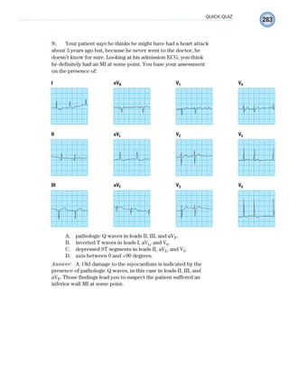 283
QUICK QUIZ
9. Your patient says he thinks he might have had a heart attack
about 3 years ago but, because he never went to the doctor, he
doesn’t know for sure. Looking at his admission ECG, you think
he definitely had an MI at some point. You base your assessment
on the presence of:
V2 V5
aVL
II
V3 V6
aVF
III
V1
aVR
I V4
A. pathologic Q waves in leads II, III, and aVF.
B. inverted T waves in leads I, aVL, and V6.
C. depressed ST segments in leads II, aVL, and V5.
D. axis between 0 and +90 degrees.
Answer: A. Old damage to the myocardium is indicated by the
presence of pathologic Q waves, in this case in leads II, III, and
aVF. Those findings lead you to suspect the patient suffered an
inferior wall MI at some point.
ECG_Chap12.indd 283
ECG_Chap12.indd 283 7/8/2010 4:38:16 PM
7/8/2010 4:38:16 PM
 