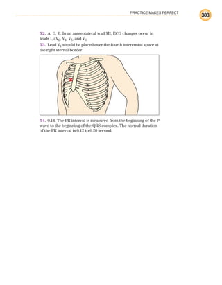 PRACTICE MAKES PERFECT
303
52. A, D, E. In an anterolateral wall MI, ECG changes occur in
leads I, aVL, V4, V5, and V6.
53. Lead V1 should be placed over the fourth intercostal space at
the right sternal border.
54. 0.14. The PR interval is measured from the beginning of the P
wave to the beginning of the QRS complex. The normal duration
of the PR interval is 0.12 to 0.20 second.
ECG_BM.indd 303
ECG_BM.indd 303 7/7/2010 5:46:17 PM
7/7/2010 5:46:17 PM
 