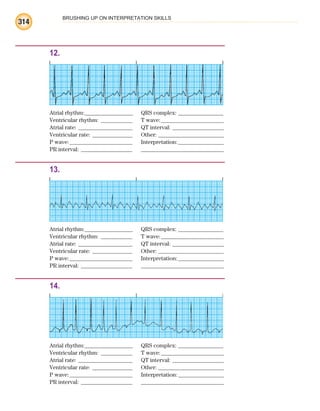 BRUSHING UP ON INTERPRETATION SKILLS
314
12.
Atrial rhythm:________________ QRS complex: _______________
Ventricular rhythm: ___________ T wave:______________________
Atrial rate: ___________________ QT interval: __________________
Ventricular rate: ______________ Other: _______________________
P wave:______________________ Interpretation:________________
PR interval: __________________ _____________________________
13.
Atrial rhythm:________________ QRS complex: _______________
Ventricular rhythm: ___________ T wave:______________________
Atrial rate: ___________________ QT interval: __________________
Ventricular rate: ______________ Other: _______________________
P wave:______________________ Interpretation:________________
PR interval: __________________ _____________________________
14.
Atrial rhythm:________________ QRS complex: _______________
Ventricular rhythm: ___________ T wave:______________________
Atrial rate: ___________________ QT interval: __________________
Ventricular rate: ______________ Other: _______________________
P wave:______________________ Interpretation:________________
PR interval: __________________ _____________________________
ECG_BM.indd 314
ECG_BM.indd 314 7/7/2010 5:46:20 PM
7/7/2010 5:46:20 PM
 