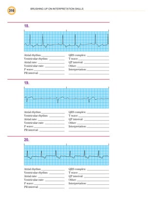 BRUSHING UP ON INTERPRETATION SKILLS
316
18.
Atrial rhythm:________________ QRS complex: _______________
Ventricular rhythm: ___________ T wave:______________________
Atrial rate: ___________________ QT interval: __________________
Ventricular rate: ______________ Other: _______________________
P wave:______________________ Interpretation:________________
PR interval: __________________ _____________________________
19.
Atrial rhythm:________________ QRS complex: _______________
Ventricular rhythm: ___________ T wave:______________________
Atrial rate: ___________________ QT interval: __________________
Ventricular rate: ______________ Other: _______________________
P wave:______________________ Interpretation:________________
PR interval: __________________ _____________________________
20.
Atrial rhythm:________________ QRS complex: _______________
Ventricular rhythm: ___________ T wave:______________________
Atrial rate: ___________________ QT interval: __________________
Ventricular rate: ______________ Other: _______________________
P wave:______________________ Interpretation:________________
PR interval: __________________ _____________________________
ECG_BM.indd 316
ECG_BM.indd 316 7/7/2010 5:46:21 PM
7/7/2010 5:46:21 PM
 