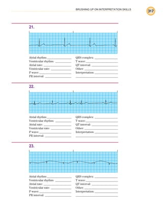 BRUSHING UP ON INTERPRETATION SKILLS
317
21.
Atrial rhythm:________________ QRS complex: _______________
Ventricular rhythm: ___________ T wave:______________________
Atrial rate: ___________________ QT interval: __________________
Ventricular rate: ______________ Other: _______________________
P wave:______________________ Interpretation:________________
PR interval: __________________ _____________________________
22.
Atrial rhythm:________________ QRS complex: _______________
Ventricular rhythm: ___________ T wave:______________________
Atrial rate: ___________________ QT interval: __________________
Ventricular rate: ______________ Other: _______________________
P wave:______________________ Interpretation:________________
PR interval: __________________ _____________________________
23.
Atrial rhythm:________________ QRS complex: _______________
Ventricular rhythm: ___________ T wave:______________________
Atrial rate: ___________________ QT interval: __________________
Ventricular rate: ______________ Other: _______________________
P wave:______________________ Interpretation:________________
PR interval: __________________ _____________________________
ECG_BM.indd 317
ECG_BM.indd 317 7/7/2010 5:46:21 PM
7/7/2010 5:46:21 PM
 