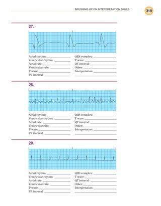 BRUSHING UP ON INTERPRETATION SKILLS
319
27.
Atrial rhythm:________________ QRS complex: _______________
Ventricular rhythm: ___________ T wave:______________________
Atrial rate: ___________________ QT interval: __________________
Ventricular rate: ______________ Other: _______________________
P wave:______________________ Interpretation:________________
PR interval: __________________ _____________________________
28.
Atrial rhythm:________________ QRS complex: _______________
Ventricular rhythm: ___________ T wave:______________________
Atrial rate: ___________________ QT interval: __________________
Ventricular rate: ______________ Other: _______________________
P wave:______________________ Interpretation:________________
PR interval: __________________ _____________________________
29.
Atrial rhythm:________________ QRS complex: _______________
Ventricular rhythm: ___________ T wave:______________________
Atrial rate: ___________________ QT interval: __________________
Ventricular rate: ______________ Other: _______________________
P wave:______________________ Interpretation:________________
PR interval: __________________ _____________________________
ECG_BM.indd 319
ECG_BM.indd 319 7/7/2010 5:46:23 PM
7/7/2010 5:46:23 PM
 