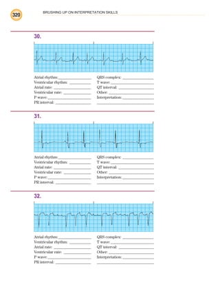 BRUSHING UP ON INTERPRETATION SKILLS
320
30.
Atrial rhythm:________________ QRS complex: _______________
Ventricular rhythm: ___________ T wave:______________________
Atrial rate: ___________________ QT interval: __________________
Ventricular rate: ______________ Other: _______________________
P wave:______________________ Interpretation:________________
PR interval: __________________ _____________________________
31.
Atrial rhythm:________________ QRS complex: _______________
Ventricular rhythm: ___________ T wave:______________________
Atrial rate: ___________________ QT interval: __________________
Ventricular rate: ______________ Other: _______________________
P wave:______________________ Interpretation:________________
PR interval: __________________ _____________________________
32.
Atrial rhythm:________________ QRS complex: _______________
Ventricular rhythm: ___________ T wave:______________________
Atrial rate: ___________________ QT interval: __________________
Ventricular rate: ______________ Other: _______________________
P wave:______________________ Interpretation:________________
PR interval: __________________ _____________________________
ECG_BM.indd 320
ECG_BM.indd 320 7/7/2010 5:46:24 PM
7/7/2010 5:46:24 PM
 