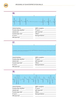 BRUSHING UP ON INTERPRETATION SKILLS
322
36.
Atrial rhythm:________________ QRS complex: _______________
Ventricular rhythm: ___________ T wave:______________________
Atrial rate: ___________________ QT interval: __________________
Ventricular rate: ______________ Other: _______________________
P wave:______________________ Interpretation:________________
PR interval: __________________ _____________________________
37.
Atrial rhythm:________________ QRS complex: _______________
Ventricular rhythm: ___________ T wave:______________________
Atrial rate: ___________________ QT interval: __________________
Ventricular rate: ______________ Other: _______________________
P wave:______________________ Interpretation:________________
PR interval: __________________ _____________________________
38.
Atrial rhythm:________________ QRS complex: _______________
Ventricular rhythm: ___________ T wave:______________________
Atrial rate: ___________________ QT interval: __________________
Ventricular rate: ______________ Other: _______________________
P wave:______________________ Interpretation:________________
PR interval: __________________ _____________________________
ECG_BM.indd 322
ECG_BM.indd 322 7/7/2010 5:46:26 PM
7/7/2010 5:46:26 PM
 