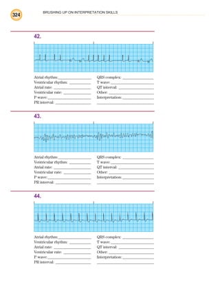 BRUSHING UP ON INTERPRETATION SKILLS
324
42.
Atrial rhythm:________________ QRS complex: _______________
Ventricular rhythm: ___________ T wave:______________________
Atrial rate: ___________________ QT interval: __________________
Ventricular rate: ______________ Other: _______________________
P wave:______________________ Interpretation:________________
PR interval: __________________ _____________________________
43.
Atrial rhythm:________________ QRS complex: _______________
Ventricular rhythm: ___________ T wave:______________________
Atrial rate: ___________________ QT interval: __________________
Ventricular rate: ______________ Other: _______________________
P wave:______________________ Interpretation:________________
PR interval: __________________ _____________________________
44.
Atrial rhythm:________________ QRS complex: _______________
Ventricular rhythm: ___________ T wave:______________________
Atrial rate: ___________________ QT interval: __________________
Ventricular rate: ______________ Other: _______________________
P wave:______________________ Interpretation:________________
PR interval: __________________ _____________________________
ECG_BM.indd 324
ECG_BM.indd 324 7/7/2010 5:46:27 PM
7/7/2010 5:46:27 PM
 